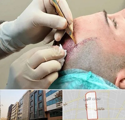 اسکالپ موی سر در نجات اللهی