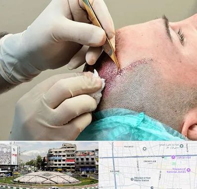 اسکالپ موی سر در مرکز تهران