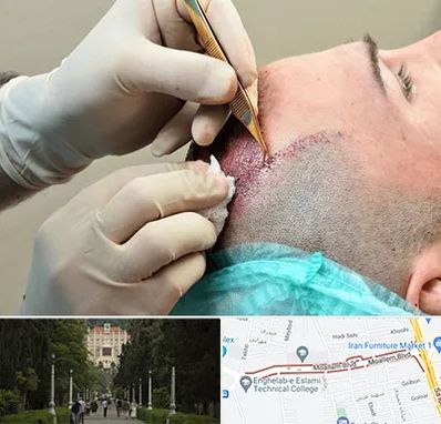 اسکالپ موی سر در بلوار معلم رشت 