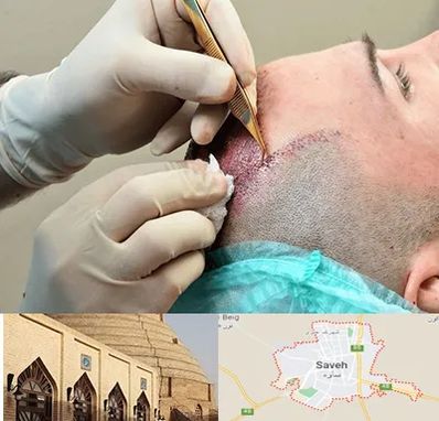 اسکالپ موی سر در ساوه