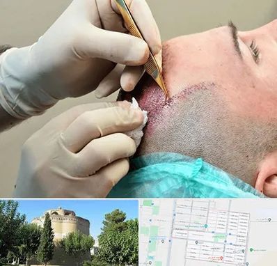 اسکالپ موی سر در مرداویج اصفهان 