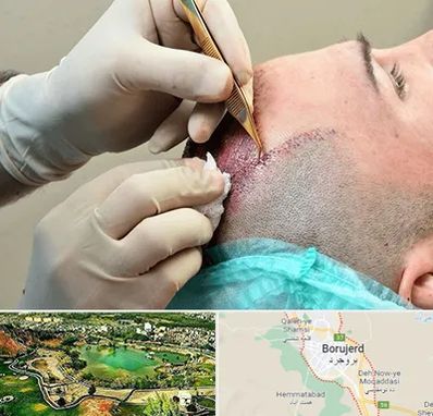 اسکالپ موی سر در بروجرد