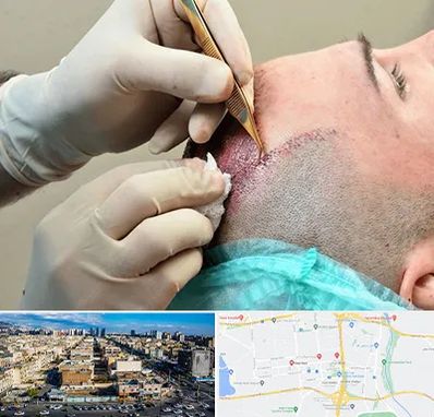 اسکالپ موی سر در شهرک راه آهن 