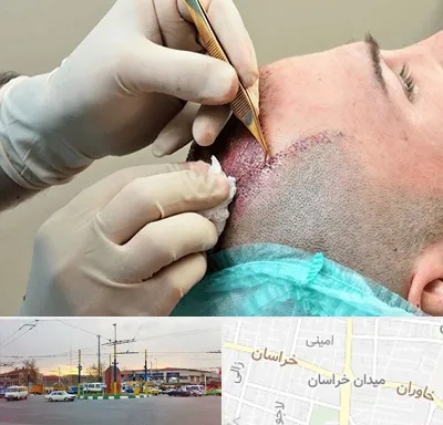 اسکالپ موی سر در میدان خراسان