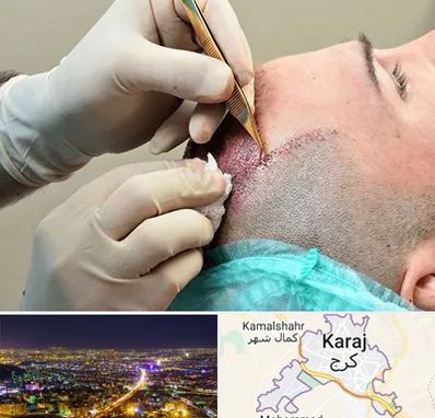اسکالپ موی سر در کرج