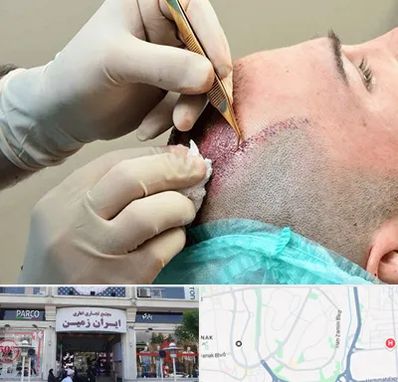 اسکالپ موی سر در ایران زمین