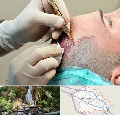 اسکالپ موی سر در الیگودرز