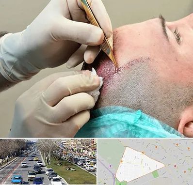 اسکالپ موی سر در احمدآباد مشهد 