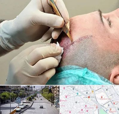 اسکالپ موی سر در خیابان زند شیراز 