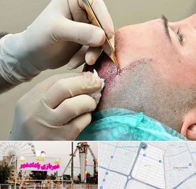 اسکالپ موی سر در پادادشهر اهواز