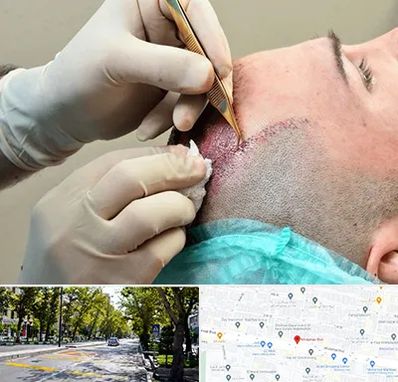 اسکالپ موی سر در میرداماد 