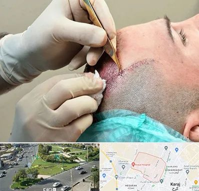 اسکالپ موی سر در شاهین ویلا کرج 