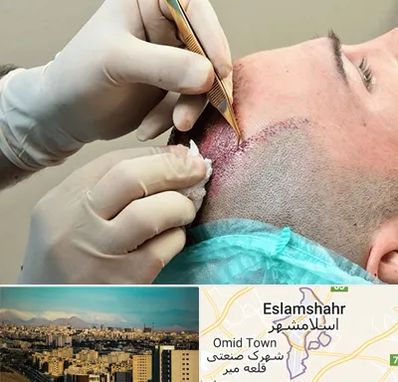 اسکالپ موی سر در اسلامشهر