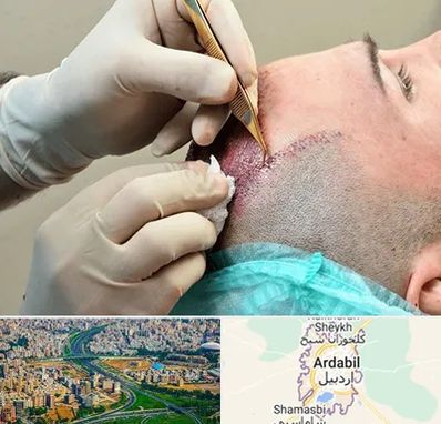 اسکالپ موی سر در اردبیل