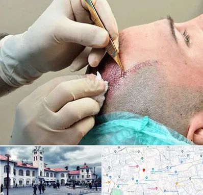 اسکالپ موی سر در میدان شهرداری رشت 