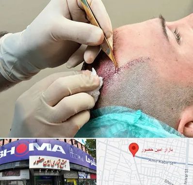 اسکالپ موی سر در امین حضور