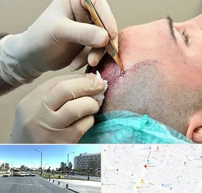 اسکالپ موی سر در بلوار کلاهدوز مشهد 