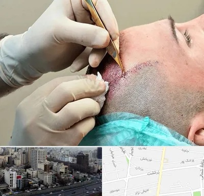 اسکالپ موی سر در زرتشت