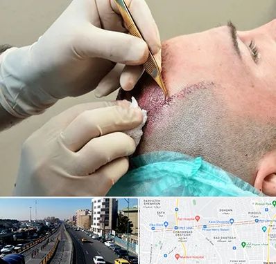 اسکالپ موی سر در پیروزی 