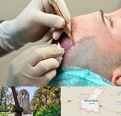 اسکالپ موی سر در نیشابور