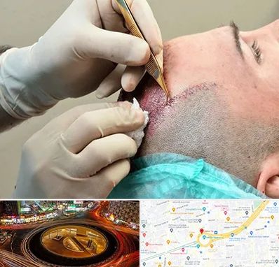 اسکالپ موی سر در میدان ولیعصر 