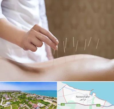 درای نیدلینگ در نوشهر