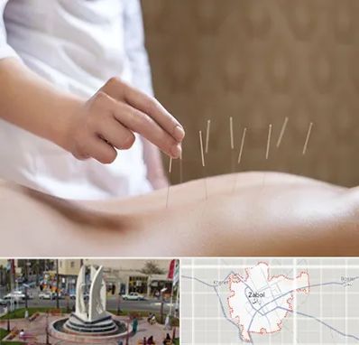 درای نیدلینگ در زابل