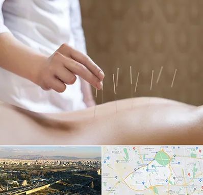 درای نیدلینگ در منطقه 19 تهران 