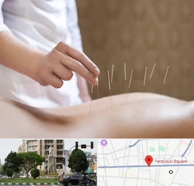 درای نیدلینگ در میدان فردوسی تهران