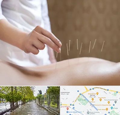 درای نیدلینگ در خیابان ارم شیراز 