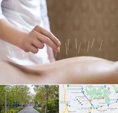 درای نیدلینگ در قدوسی غربی شیراز 