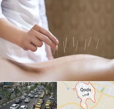 درای نیدلینگ در شهر قدس