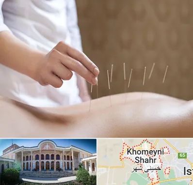 درای نیدلینگ در خمینی شهر