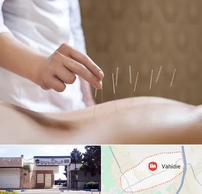 درای نیدلینگ در وحیدیه شهریار