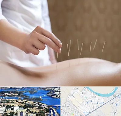 درای نیدلینگ در کوروش اهواز 