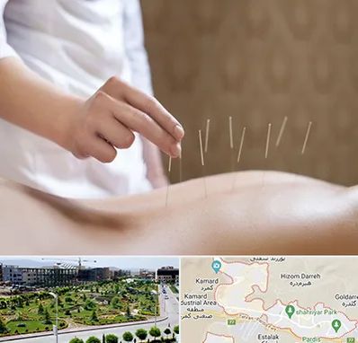 درای نیدلینگ در پردیس