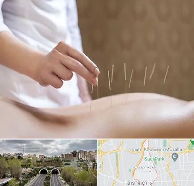 درای نیدلینگ در یوسف آباد 