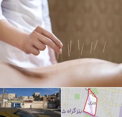درای نیدلینگ در اتابک