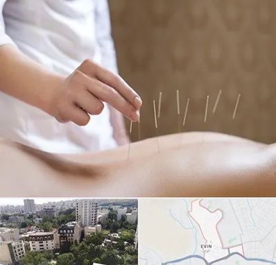 درای نیدلینگ در اوین