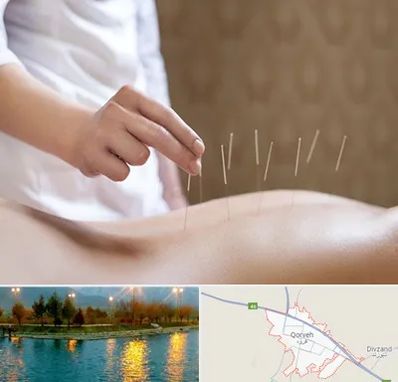درای نیدلینگ در قروه