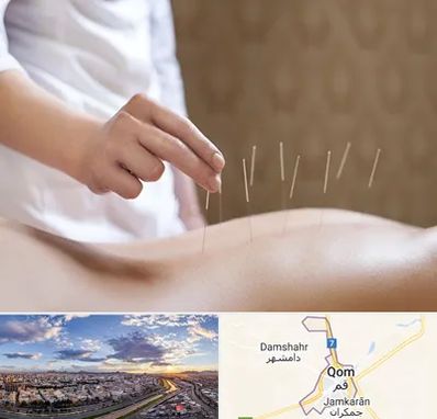 درای نیدلینگ در قم