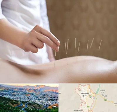 درای نیدلینگ در سنندج