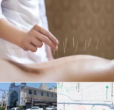 درای نیدلینگ در بلوار ابوذر