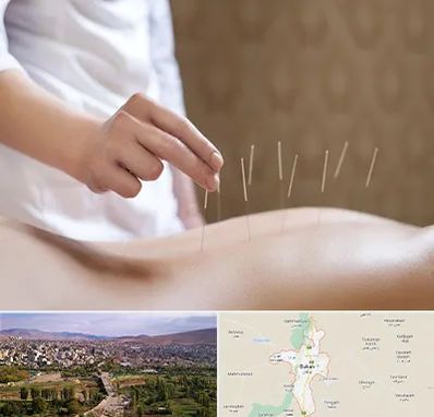 درای نیدلینگ در بوکان