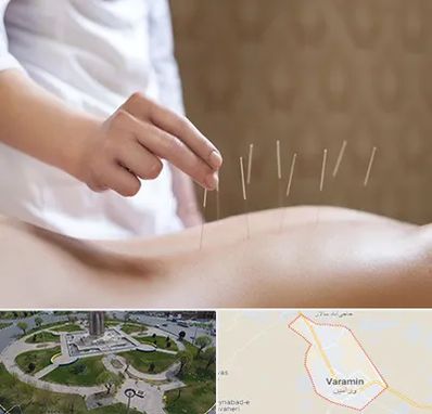 درای نیدلینگ در ورامین