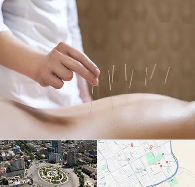 درای نیدلینگ در زرافشان اسلامشهر