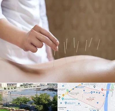 درای نیدلینگ در گلستان اهواز 