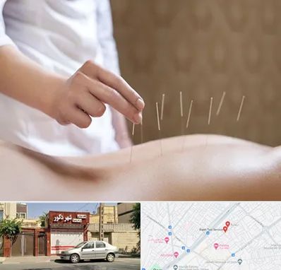 درای نیدلینگ در باجک قم