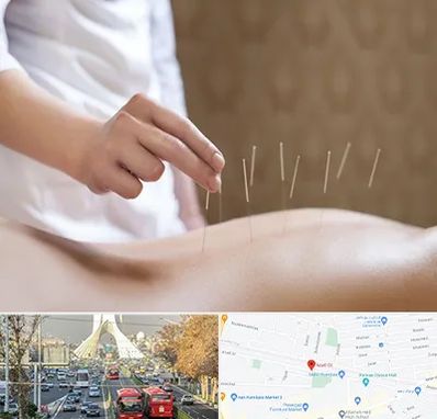 درای نیدلینگ در خیابان آزادی 