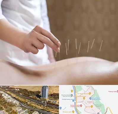 درای نیدلینگ در خیابان نیایش شیراز 